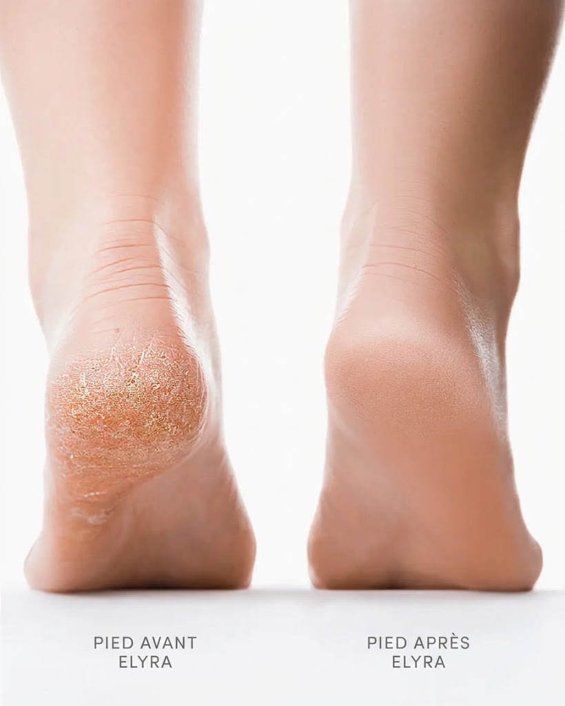Elyra Velours Pro™