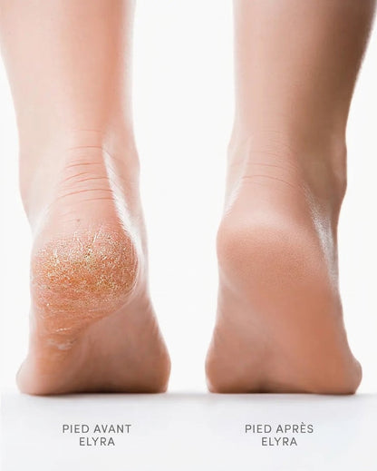 Elyra Velours Pro™